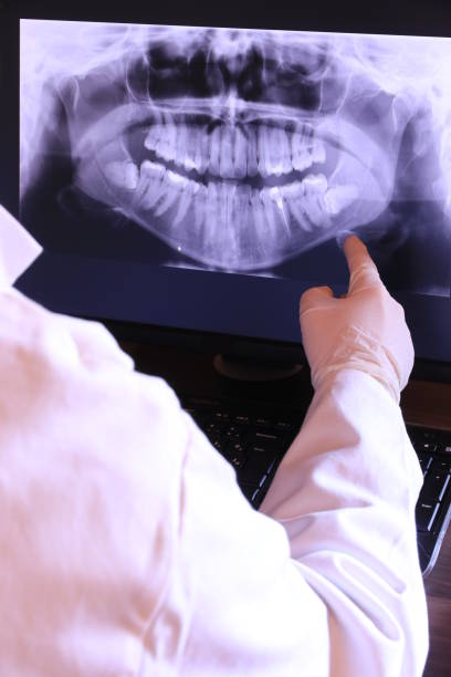 Best Emergency Dental Care for Broken or Chipped Teeth in Plantsville, CT